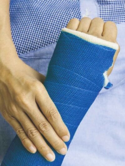 Fiberglass Casting Tape